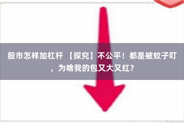 股市怎样加杠杆 【探究】不公平！都是被蚊子叮，为啥我的包又大又红？